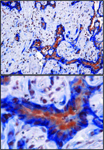 Kras-resistant 2 200x